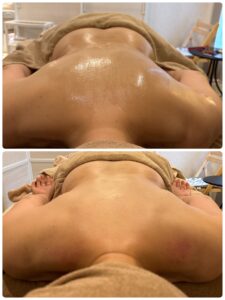 全身の筋膜を整えて血色が良くなった施術前後の比較(お客様事例1)
