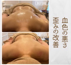 アロマリンパ全身筋膜美療コースで血行不良が改善した施術前後のビフォーアフター