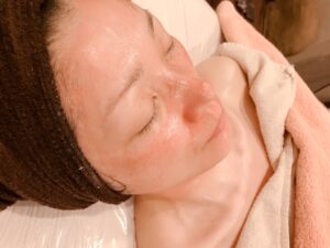 肌育クリームで血流が活性化し一時的に赤みが出ている状態